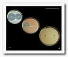 gram negative rods